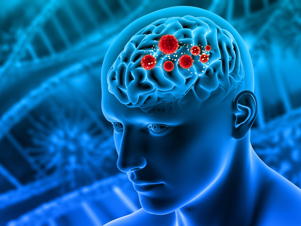 3d-render-medical-background-with-male-figure-with-tumours-brain-highlighted.jpg
