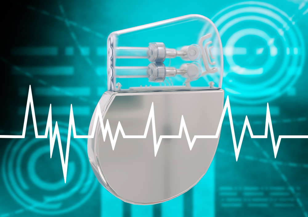 artificial-cardiac-pacemaker-isolated-graphic-background-3d-rendering.jpg