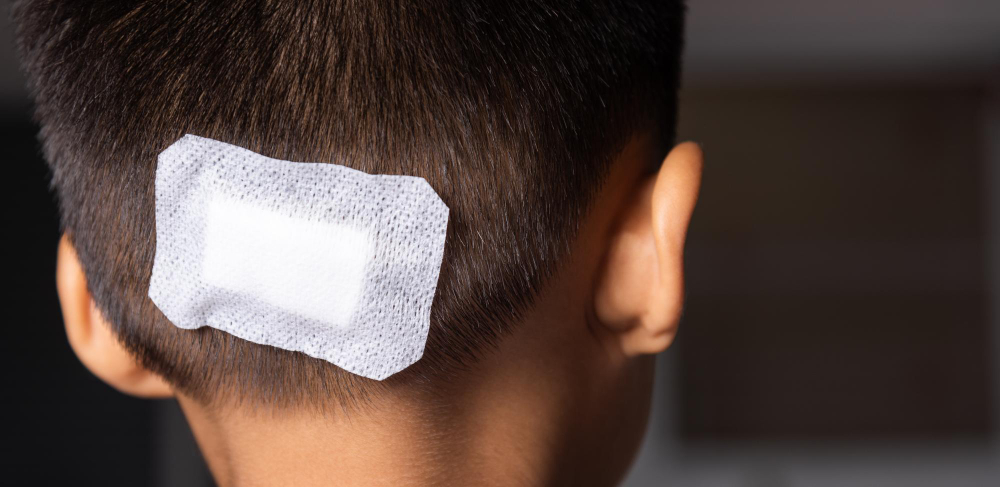 lacerated-suture-wound-kid-back-head-which-suture-with-trauma-head-by-medical-bandage.jpg